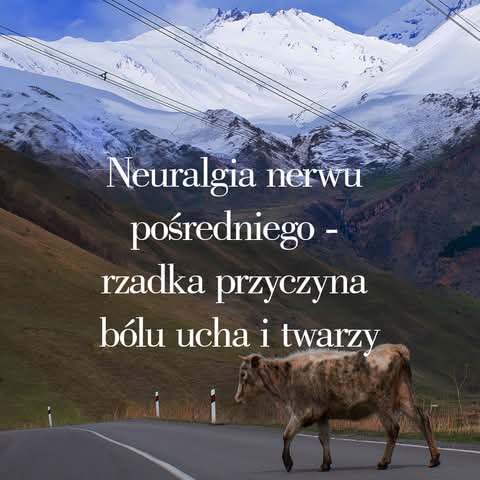 Neuralgia nerwu pośredniego (Wrisberga)